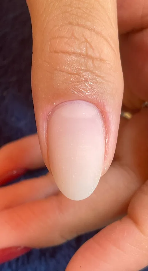 CutilagemAluna06